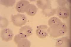 falciparum